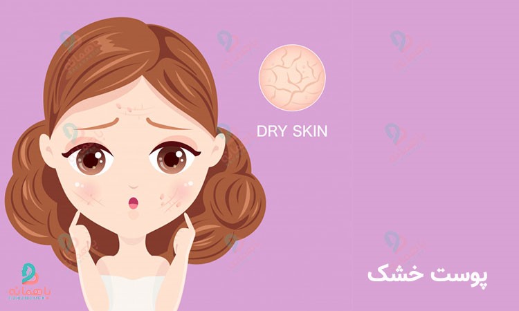 نوع پوست من چیه؟