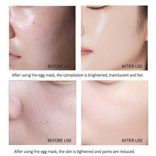 ماسک حلزون Snail Prime برند Bioaqua