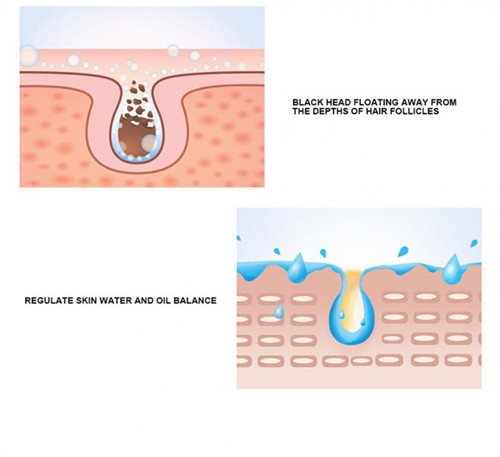 ماسک بینی سالیسیلیک اسید