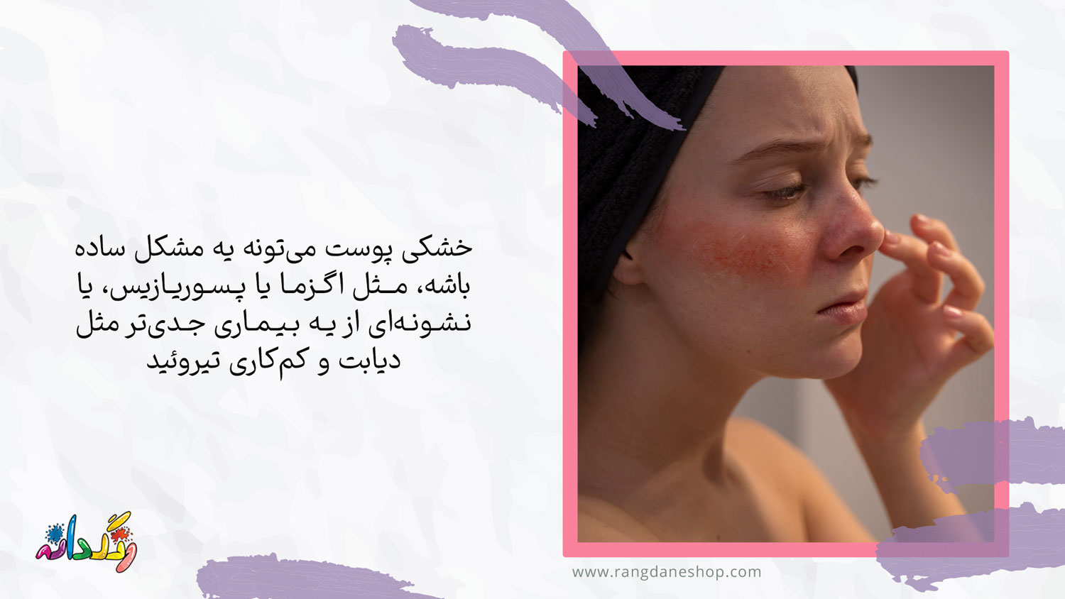 برخی از شرایط پزشکی از دلایل خشکی پوست