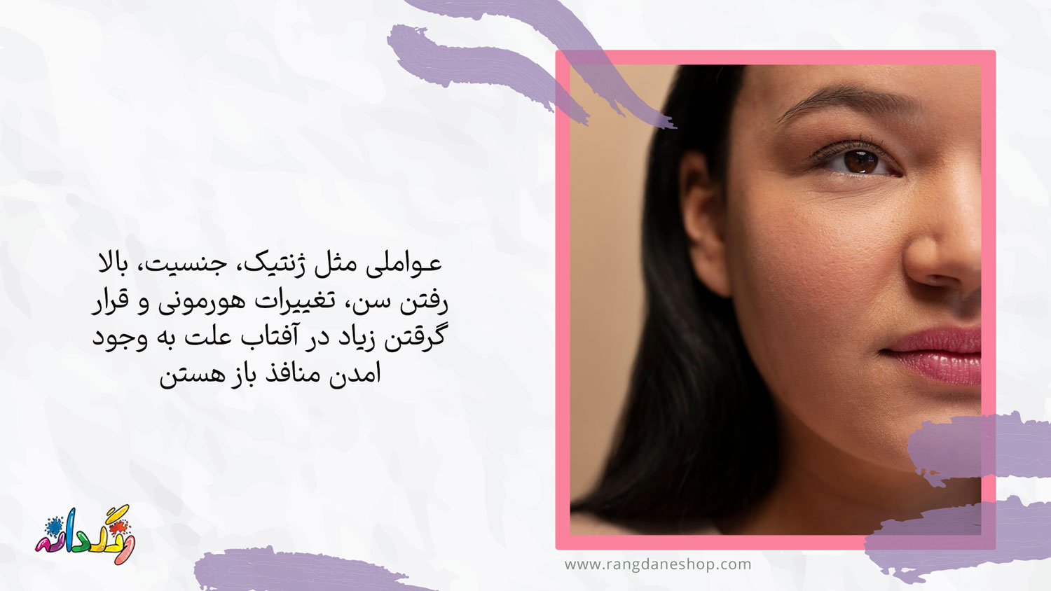 علت باز شدن منافذ پوست چیست؟