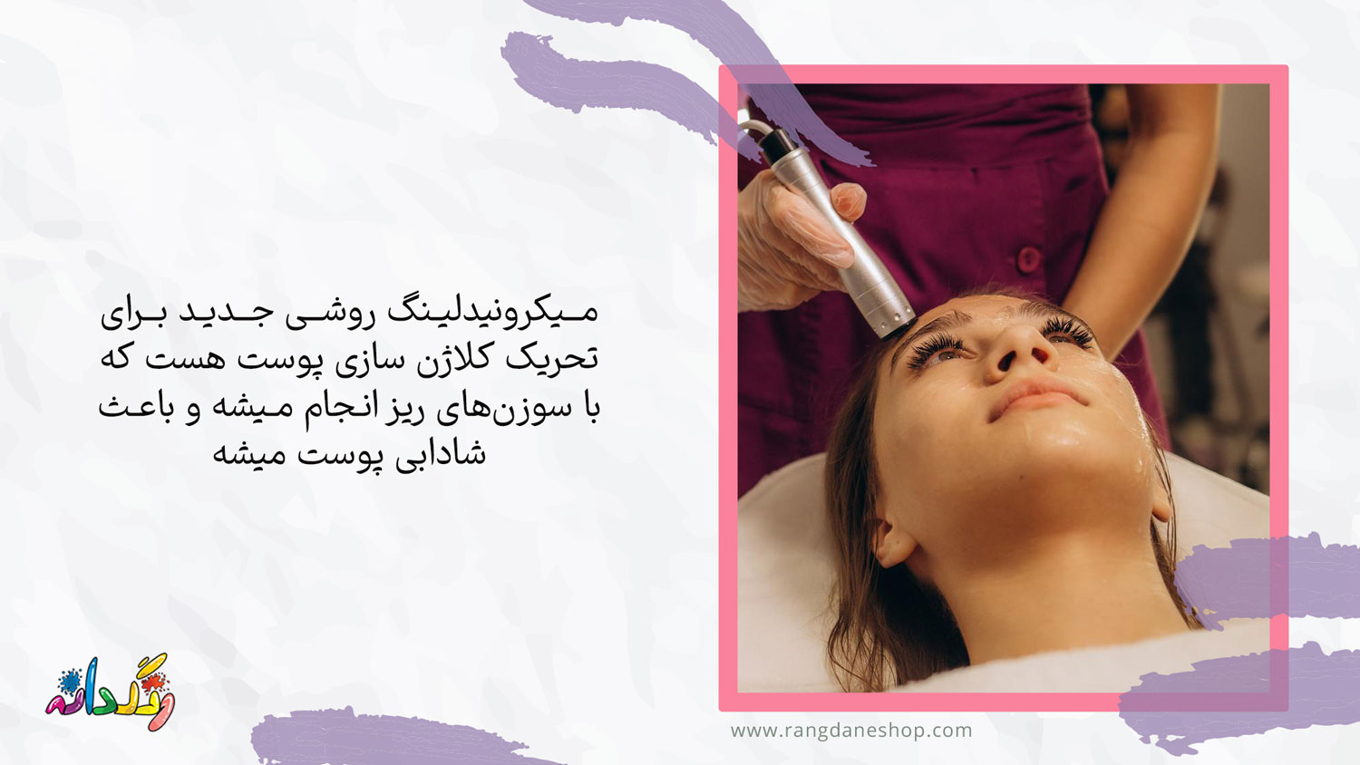 میکرونیدلینگ یکی از روش های درمان منافذ باز پوست