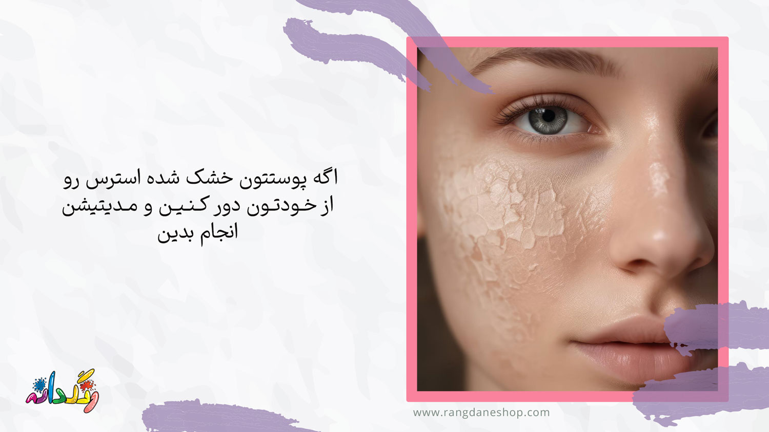 کاهش استرس یکی ا ز راه های درمان خانگی موثر برای پوست خشک